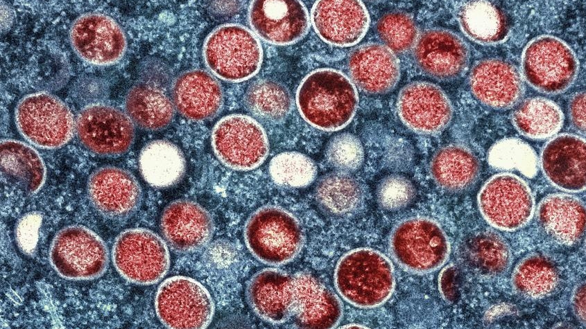 轮状病毒、诺如病毒等感染进入高发期 万一感染该怎么办？