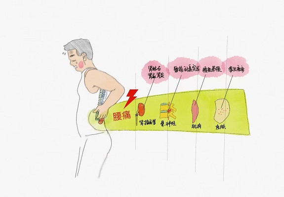 腰疼，就是肾不好？不要再盲目“补肾”了！