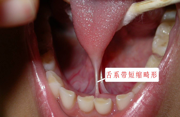 关于儿童语言发展的那些“民间传说”靠谱吗？