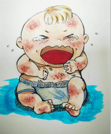 胖娃娃总吃不饱，背后可能隐藏大问题