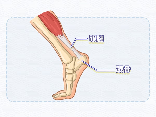 运动达人们要保护好你的跟腱，预防跟腱炎的发生！