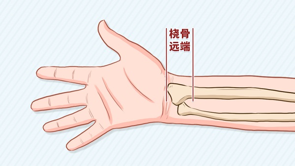 青壮年和老年胳膊容易发生的骨折--桡骨远端骨折