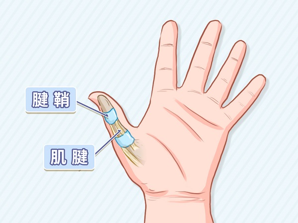 有一种病叫“妈妈手”，它就是……