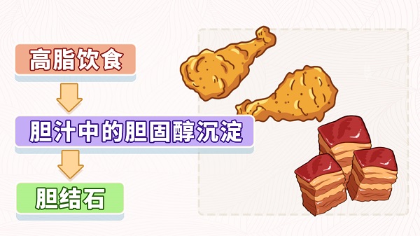 久坐不动、大鱼大肉，小心这种富贵病！