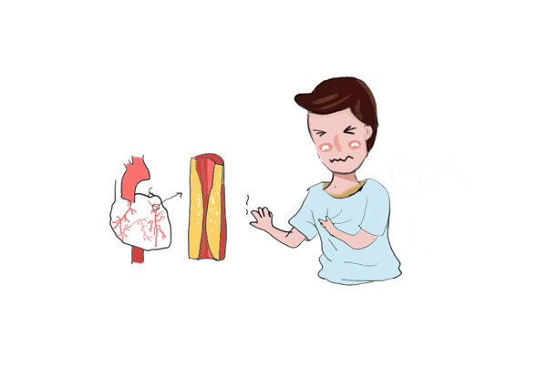 糖尿病的“难兄难弟”——糖心病