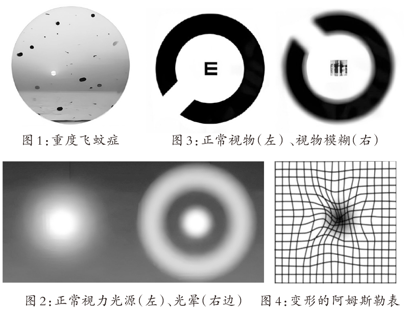 细数眼睛的八种“异象”